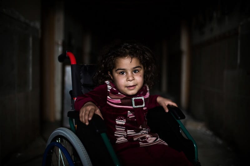 A portrait of 5-year-old Faten. She was injured when she was playing in a garden. Photo: Diego Ibarra Sánchez/MEMO